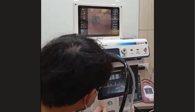 【手術案例分享：內視鏡胃腸道異物取出】